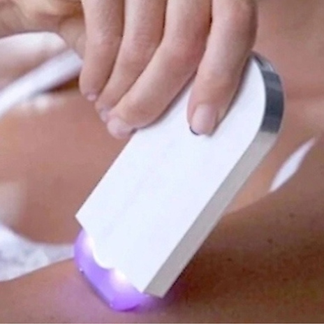 Sensor Light Hair Remover - Face, Legs, Arms and More! - With Accessories!